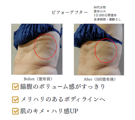 Prime C Essence ビフォーアフター①