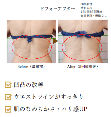 Prime C Essence ビフォーアフター②